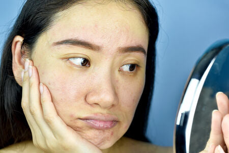 Sensitive Skin